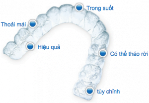 Invisalign với rất nhiều ưu điểm