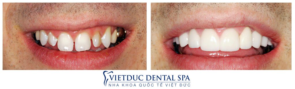 Nha Khoa Quốc Tế Việt Đức