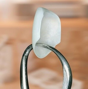 Những lợi ích của thẩm mỹ răng