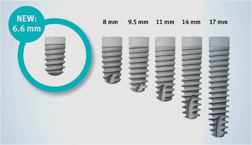 Implant Ankylos Dentsply