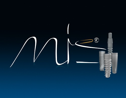 Implant Mis rất phổ biến tại Việt Nam