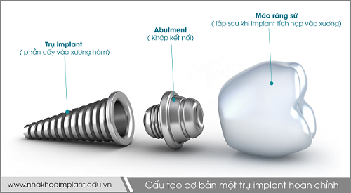 Tìm hiểu về cấu tạo của răng implant