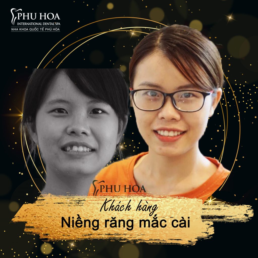 Nha Khoa Quốc Tế Việt Đức